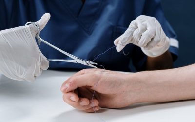 Quels facteurs prendre en compte pour choisir le fil de suture idéal ?